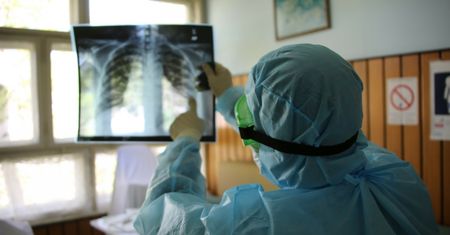Rehabilitacja po koronawirusie. Kulki do ćwiczeń oddechowych mogą pomóc na powikłania