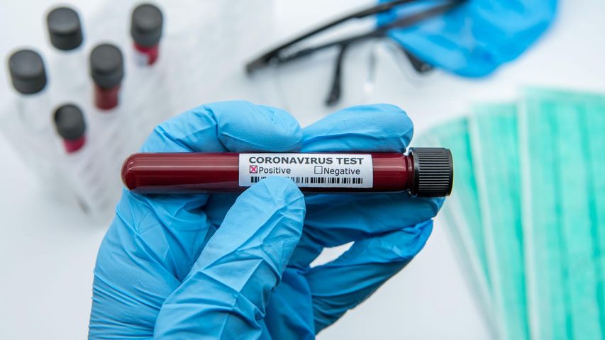 Testy serologiczne są jedną z metod potwierdzania zakażenia koronawirusem