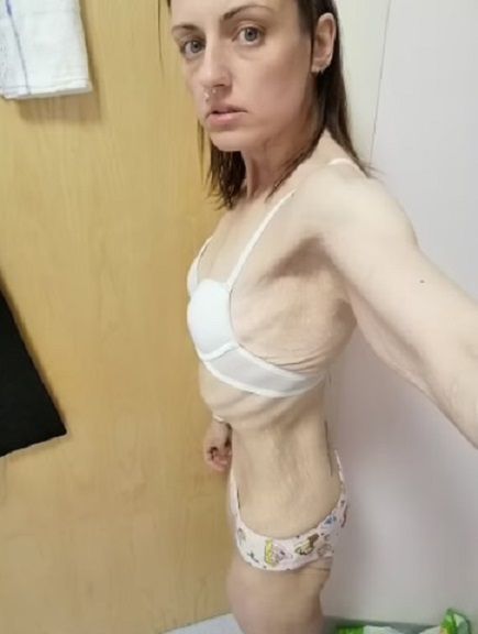 Zdrowe odchudzanie zamieniło się w obsesję