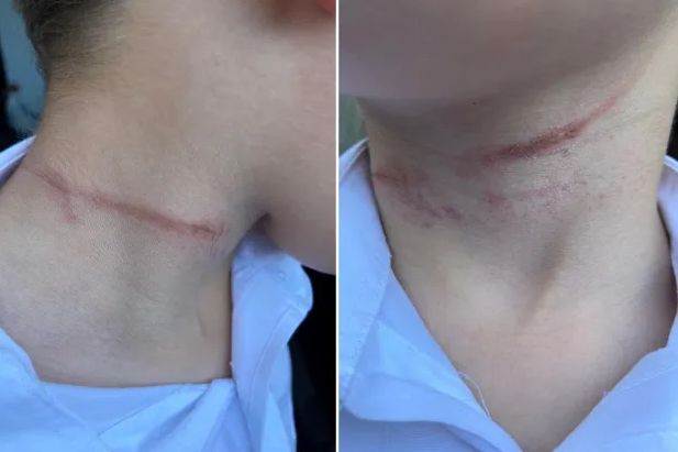 Mogło skończyć się tragicznie