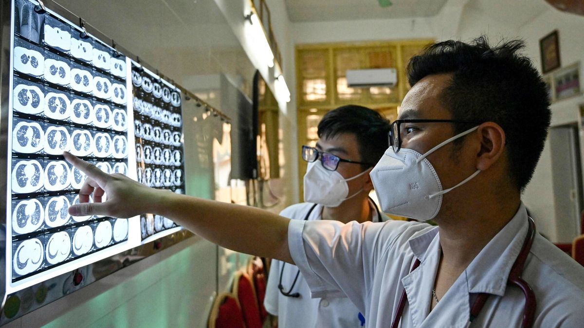 Nowa metoda leczenia gru?licy lekoopornej w regionie Azji i Pacyfiku
This picture taken on April 2, 2024 shows Vietnamese doctor Truong Duc Thai and his colleague checking X-ray film of a drug-resistant tuberculosis patient at National Lung Hospital in Hanoi. A faster and vastly more effective treatment for drug-resistant tuberculosis is being rolled out in the Asia-Pacific region, raising hopes of a "new era" in tackling one of the world's deadliest infectious diseases. (Photo by Nhac NGUYEN / AFP) / TO GO WITH "ASIA-HEALTH-TUBERCULOSIS" REPORTAGE BY PAM CASTRO
NHAC NGUYEN