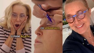 Agata Młynarska pokazała się po BLEFAROPLASTYCE POWIEK w barterze. "Nie chodziło TYLKO O ESTETYKĘ" (FOTO)