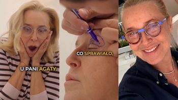 Agata Młynarska pokazała się po BLEFAROPLASTYCE POWIEK w barterze. "Nie chodziło TYLKO O ESTETYKĘ" (FOTO)