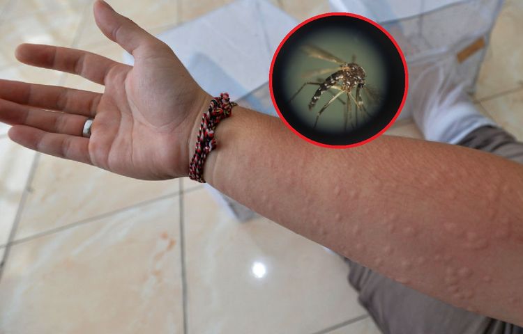 Ponad trzykrotny wzrost przypadków. W Polsce atakuje choroba przenoszona przez komary