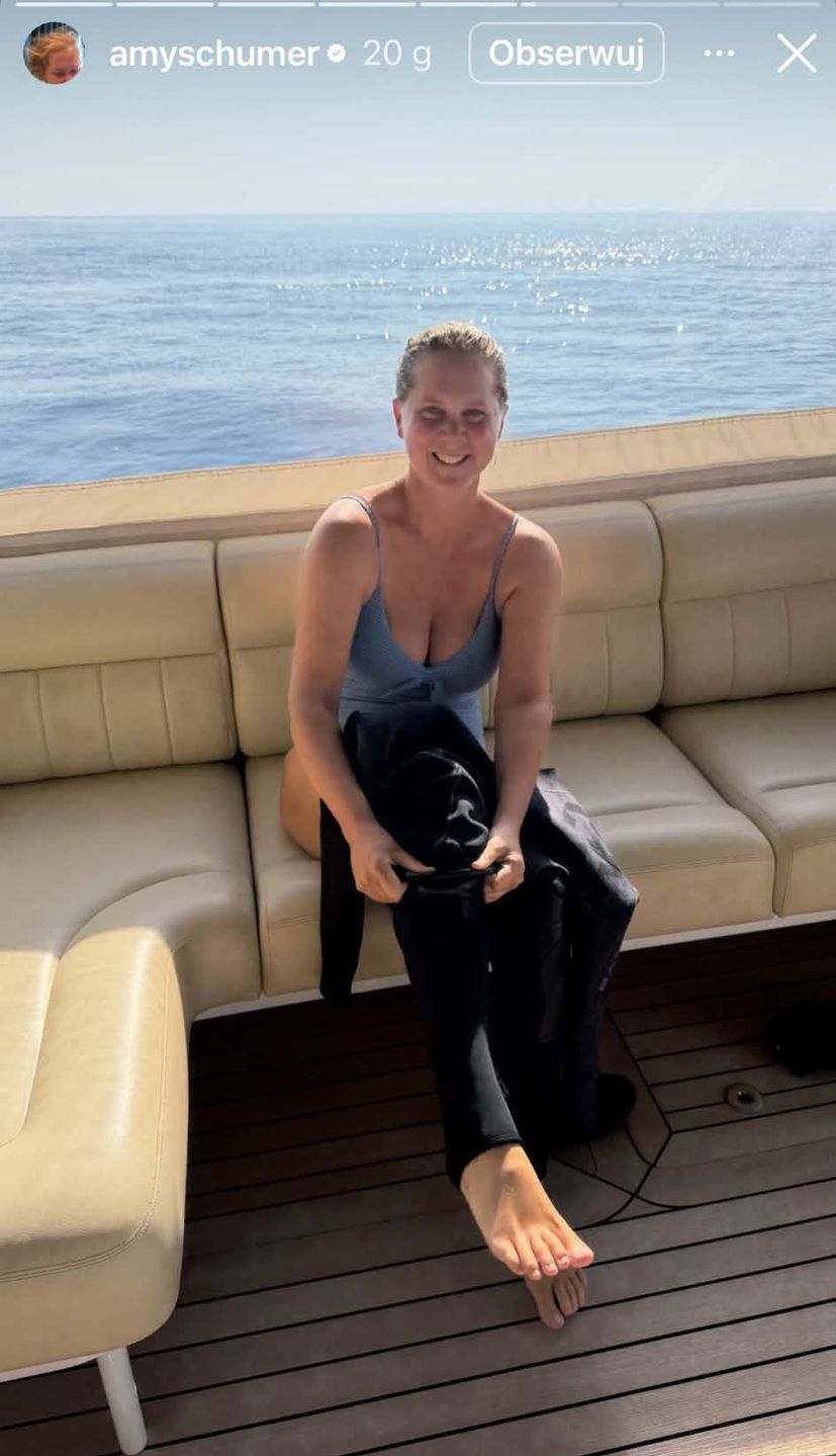 Amy Schumer