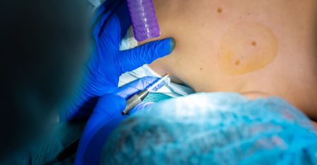 Biopsja skóry – jak przebiega? Wskazania i przeciwwskazania do badania histopatologicznego skóry
