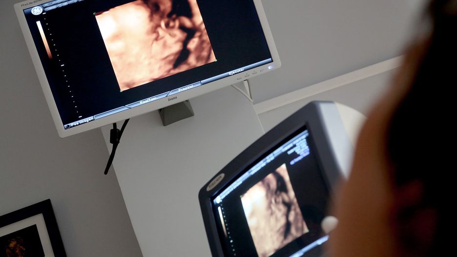 NFZ nałożył kary dla trzech placówek utrudniających terminację