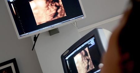 Klauzula sumienia nie ochroni lekarzy. Gigantyczne kary z NFZ