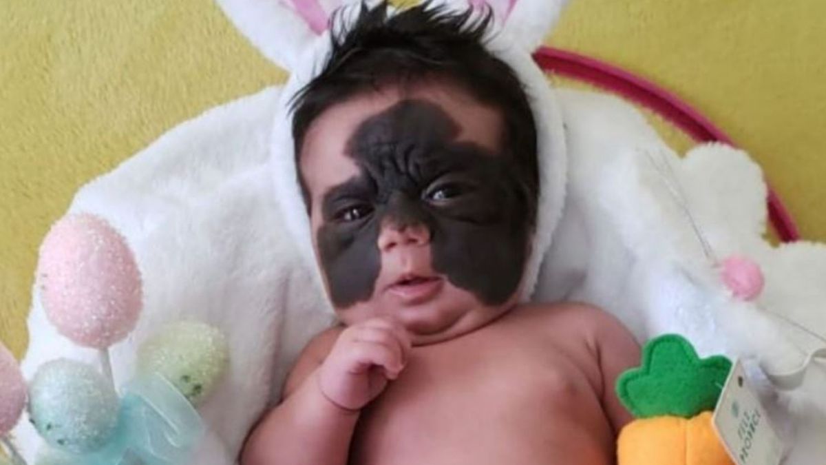 Okrzyknięto ją ‘’dzieckiem w masce Batmana’’. Niewiarygodne, jak dziś wygląda