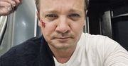 Złamał ponad 30 kości. "Jak tylko stanę na nogi, przyjadę do was"