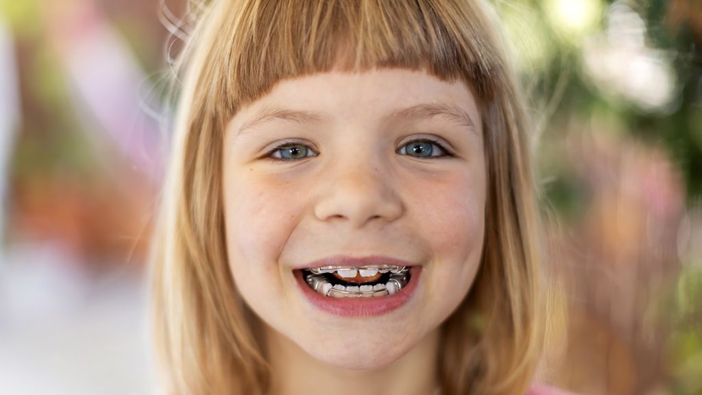 Aparat na zęby dla dzieci