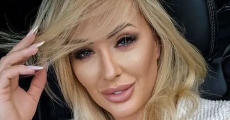 Rewolucja w życiu Sylwii Peretti: teraz chce być NATURALNA. Pokazała, jak rozpuszcza botoks (FOTO)
