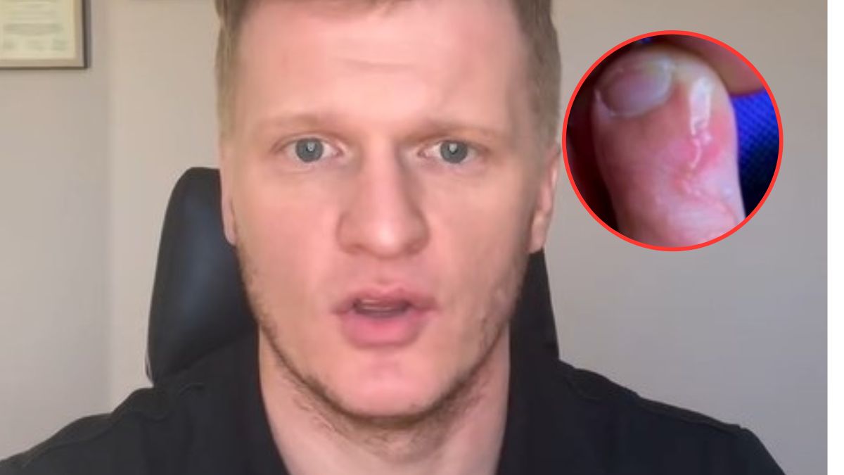 Ważna informacja dla podróżujących. Lekarz ostrzega przed pasożytami