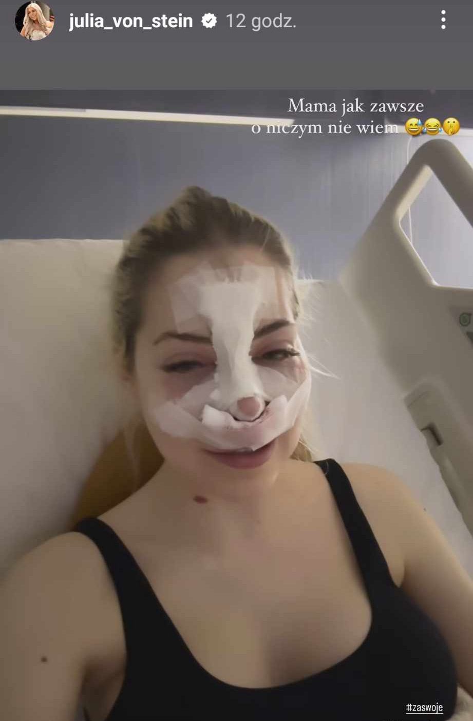 Julia von Stein po operacji nosa