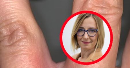 Jak zachować się po ugryzieniu przez kleszcza? Lekarka ma rady