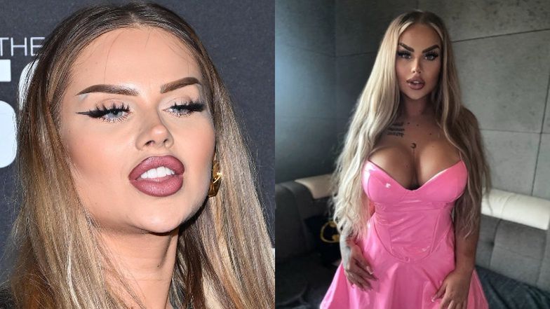 Ewel0na chce ZMNIEJSZYĆ BIUST