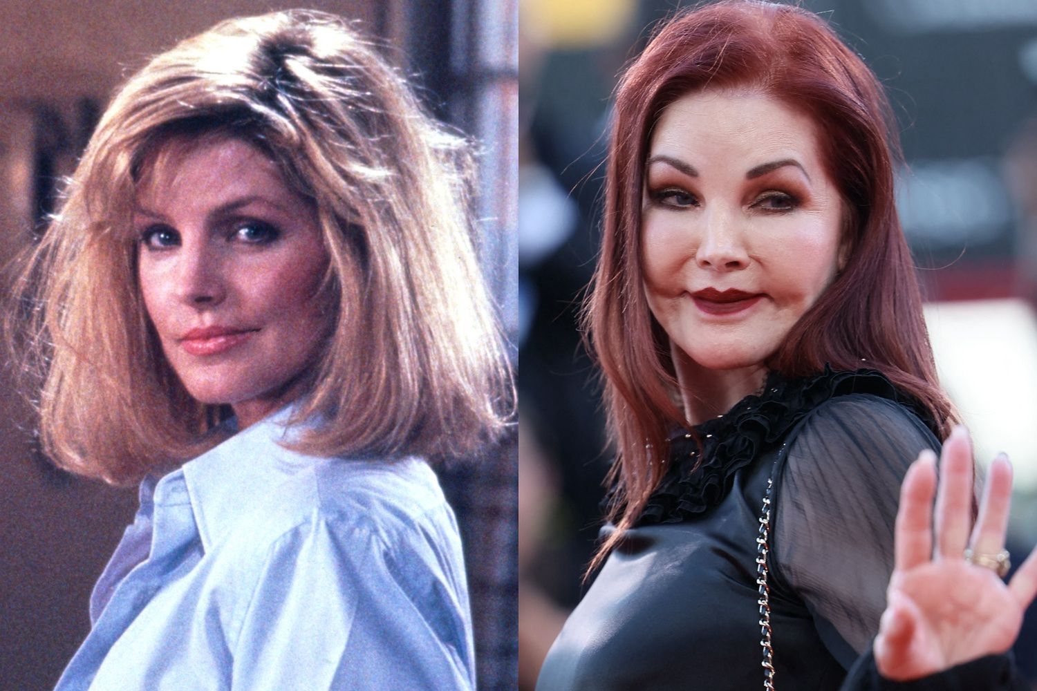 Priscilla Presley i operacje plastyczne