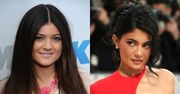 Kylie Jenner powiększyła piersi w wieku 19 LAT. Chirurg plastyczny wyliczył, co jeszcze sobie poprawiła... (ZDJĘCIA)