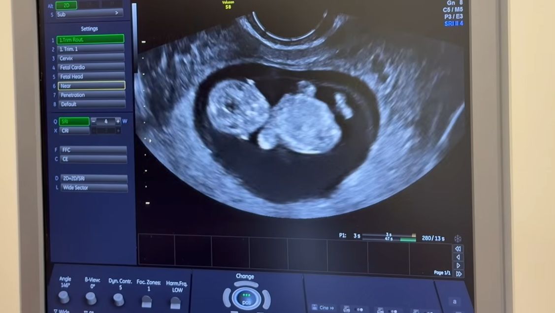 Wersow jest w ciąży 