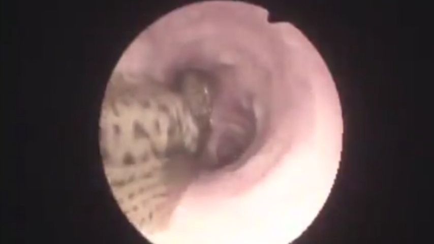 nagranie