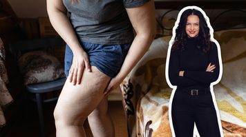 Przez lata słyszała: Taka pani uroda. Choruje Roksana, jej mama i córka