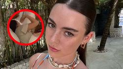 22-latka zachorowała na wymarzonych wakacjach. Zaskakujące objawy