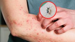 Chikungunya atakuje w Azji. WHO ostrzega przed podróżami