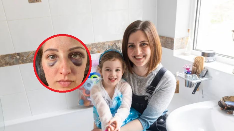 Wpadła do wanny z wodą podczas ataku padaczki. Życie uratowała jej 3-letnia córeczka