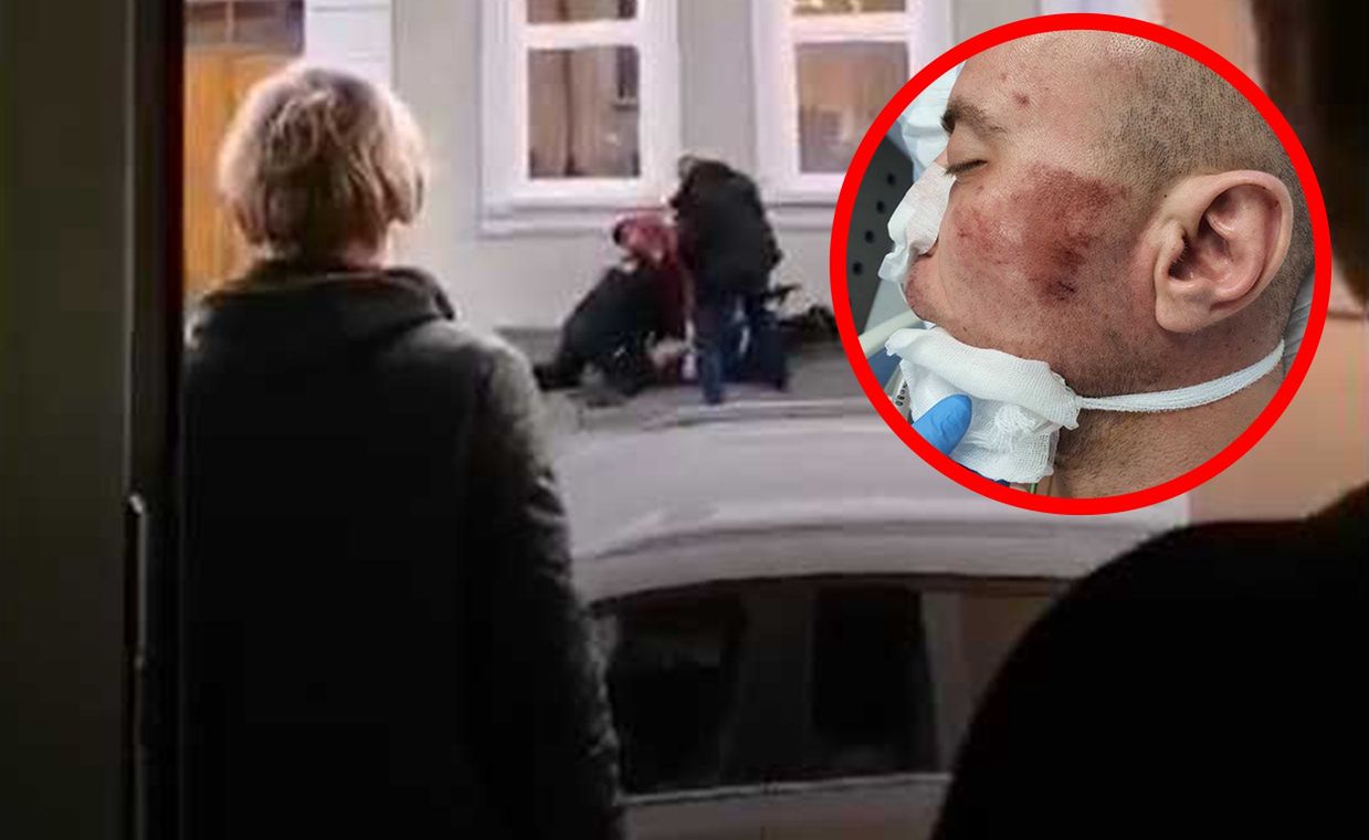 Śmierć po interwencji. "Policja nie jest już skłonna do oczyszczenia się"