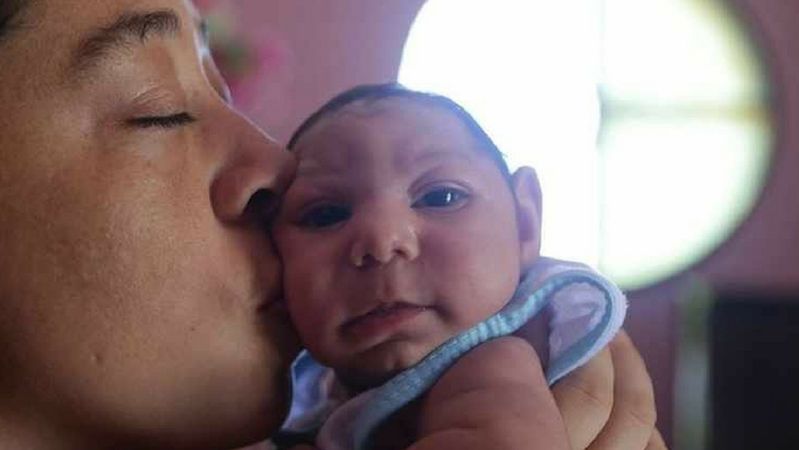 Jak wirus Zika wpływa na ciążę? Niepokojące wyniki badań