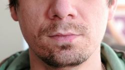 "Wirus pocałunków". Zwiększa ryzyko stwardnienia rozsianego, raka żołądka, chłoniaka