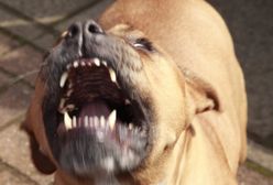 Horror w Teksasie. Rozwścieczony pies nieomal zabił właścicielkę. Zjadł jej kawałek ręki