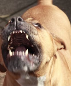 Horror w Teksasie. Rozwścieczony pies nieomal zabił właścicielkę. Zjadł jej kawałek ręki