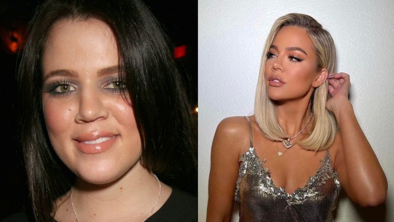 Gwiazdy, które zrobiły sobie nos