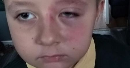 7-letni Gabryś pobity w brytyjskiej szkole. Wstrząsający powód