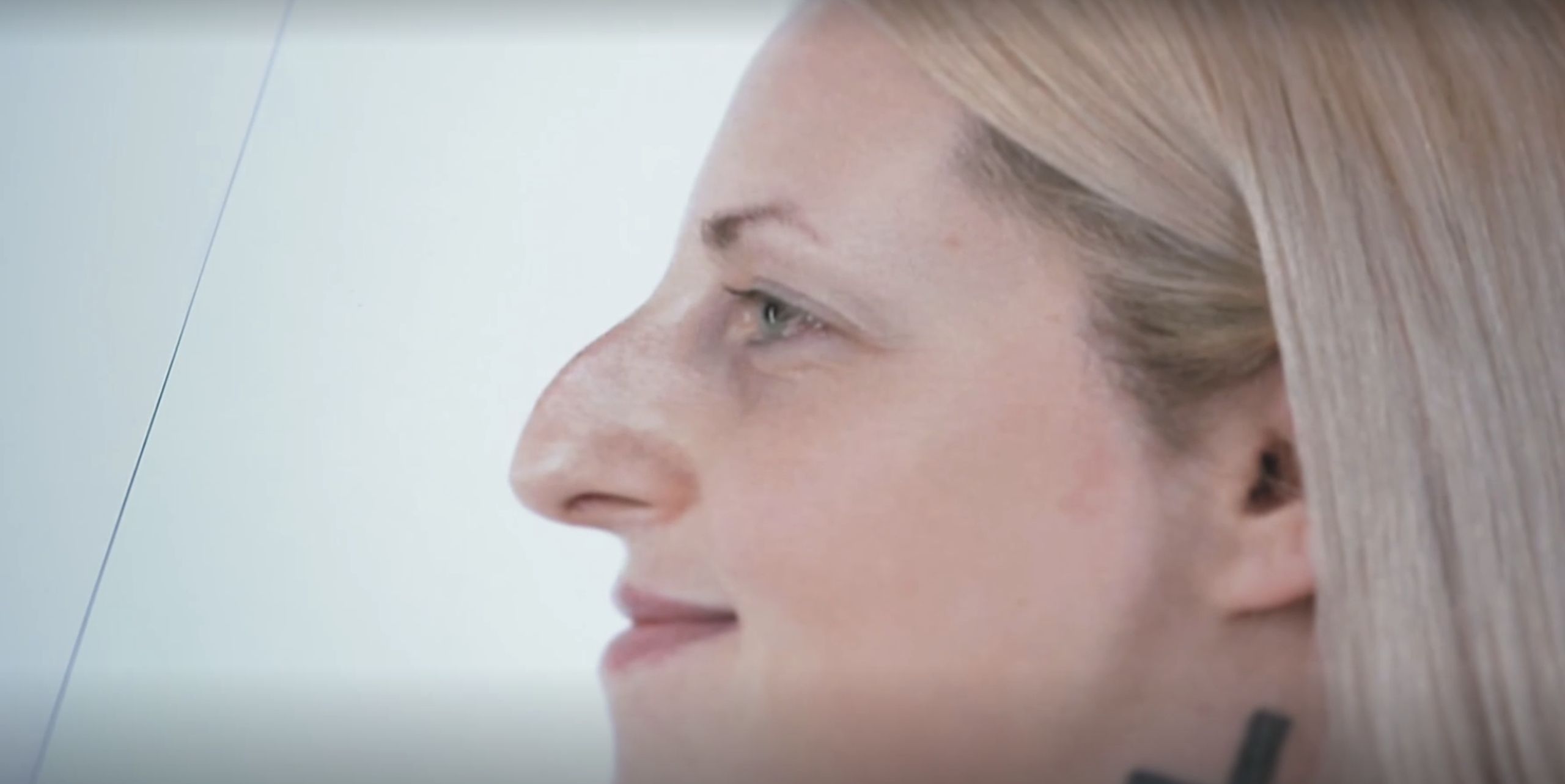 Ewelina z programu "Bez kompleksów"