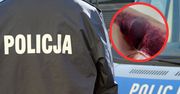 Znany z serialu policjant oskarżany o pobicie. Jest reakcja komendy