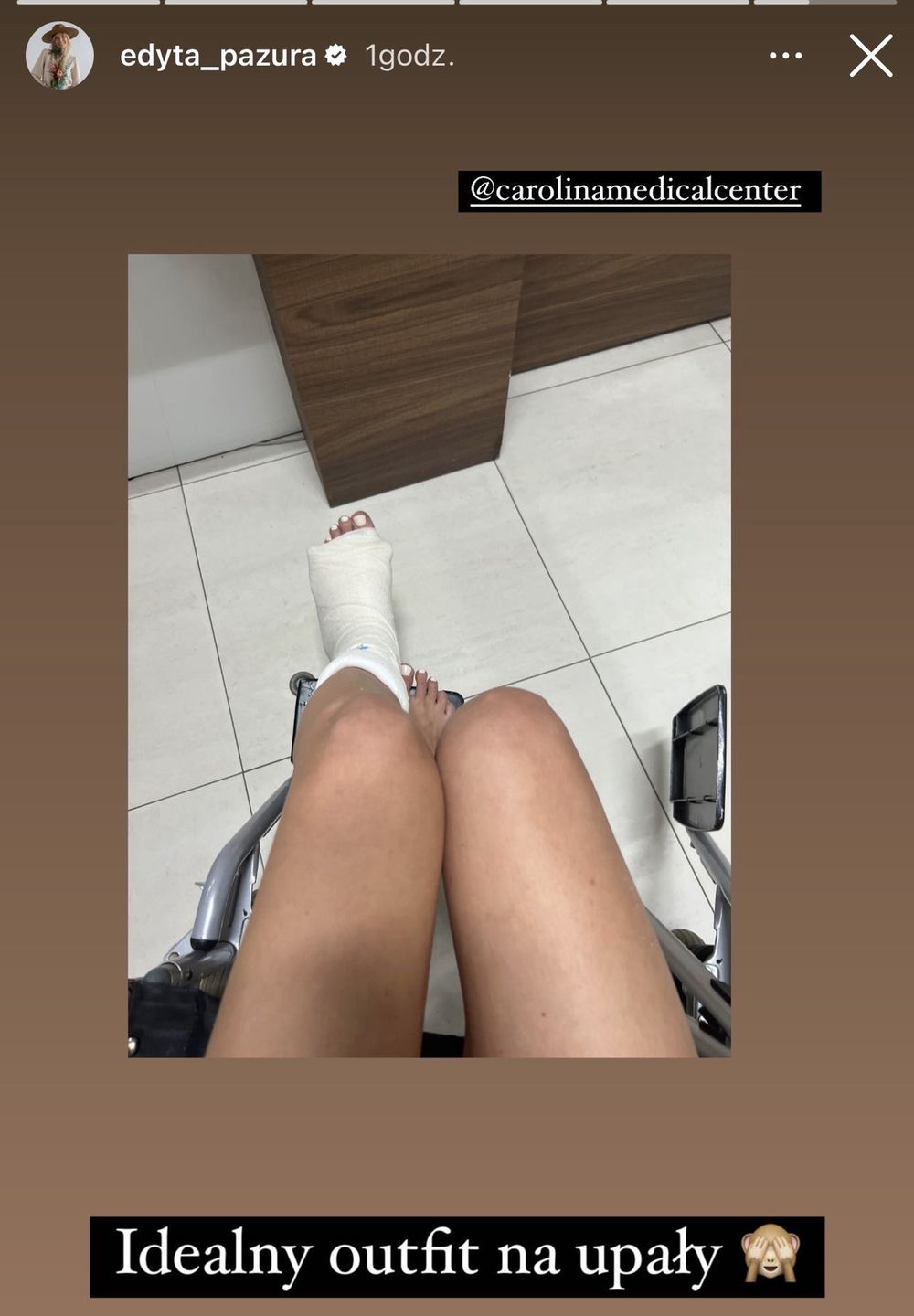 Edyta Pazura skończyła imprezę Czarka z NOGĄ W GIPSIE