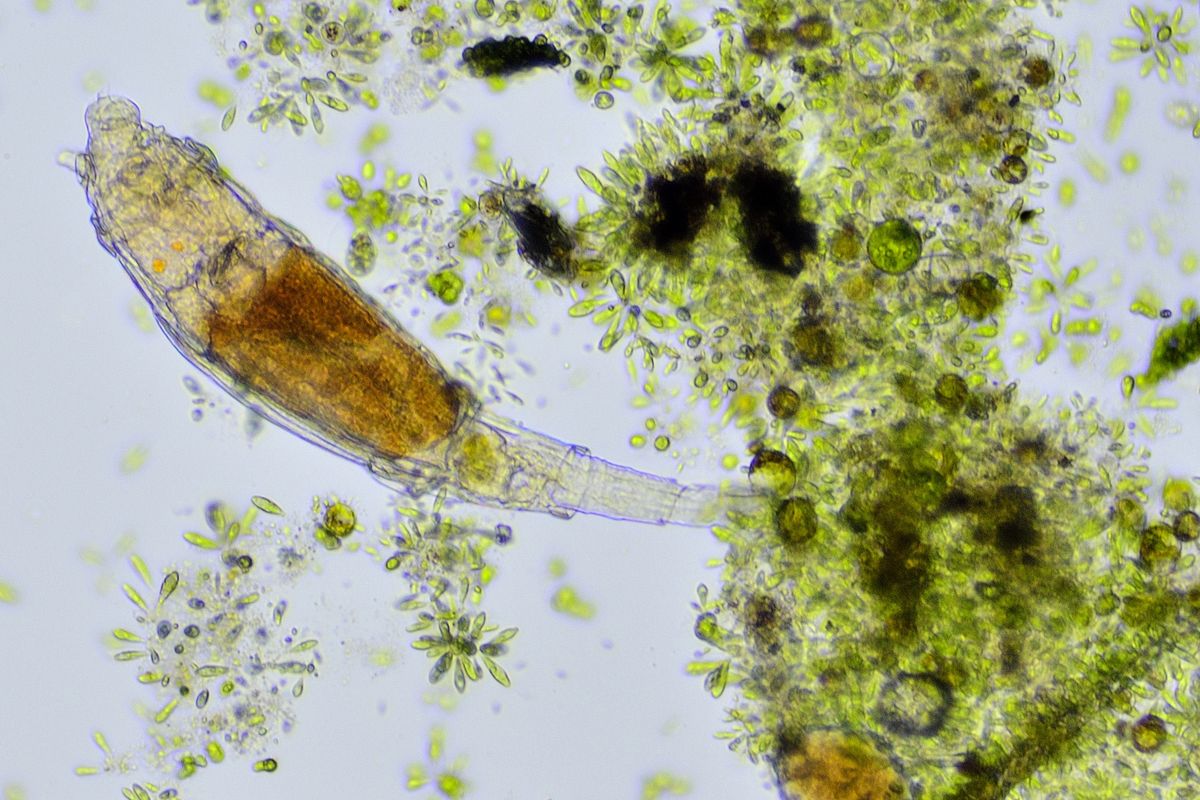 Tak wygląda ten mikroorganizm pod mikroskopem