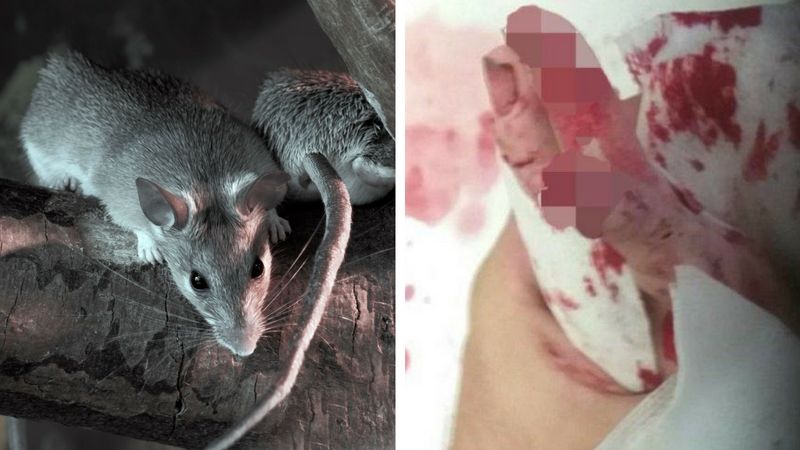 Niepełnosprawna 14-latka została dotkliwie pogryziona przez stado szczurów