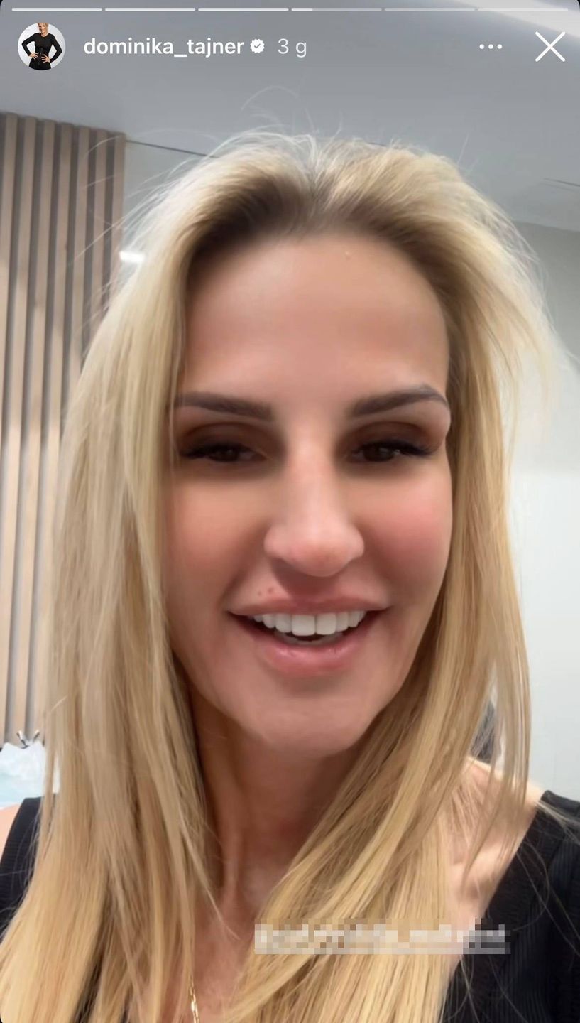 Dominika Tajner prezentuje nowy uśmiech
