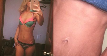 Odpowiedź dla "fitmam" z Instagrama: celebrytki pokazują swoje rozstępy (FOTO)