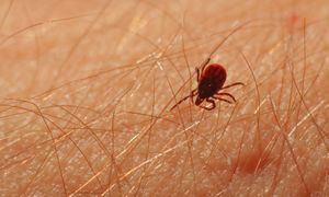 Metoda "180 stopni" na kleszcze. Weterynarz zdradza swój patent