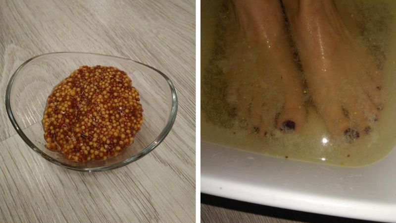 Moczenie nóg w musztardzie to sposób na walkę z przeziębieniem.