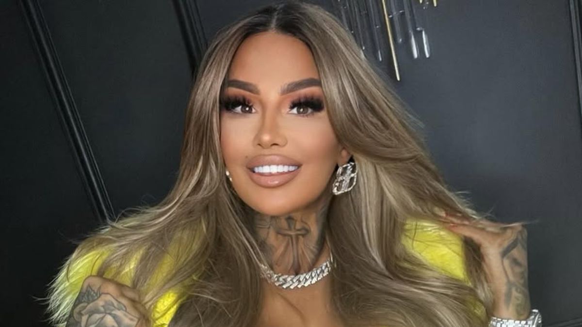 Laluna pokazała się 3 dni po operacji. "Zrobiłam sobie nową twarz"