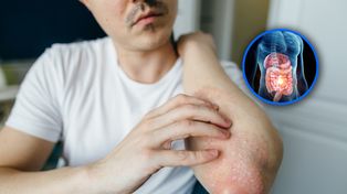 Sygnalizuje choroby jelit, trzustki. Objawy widać na skórze