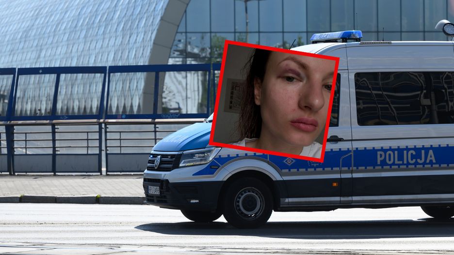 Poszkodowana udostępniła zdjęcie, na którym widać, jak wyglądała