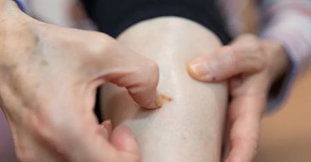 8 sygnałów. Oznaczają, że rak panoszy się w ciele
