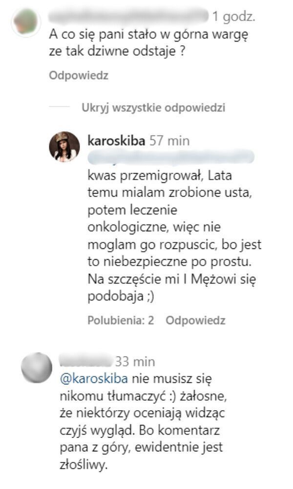 Karolina Skiba wprost o swoim wyglądzie