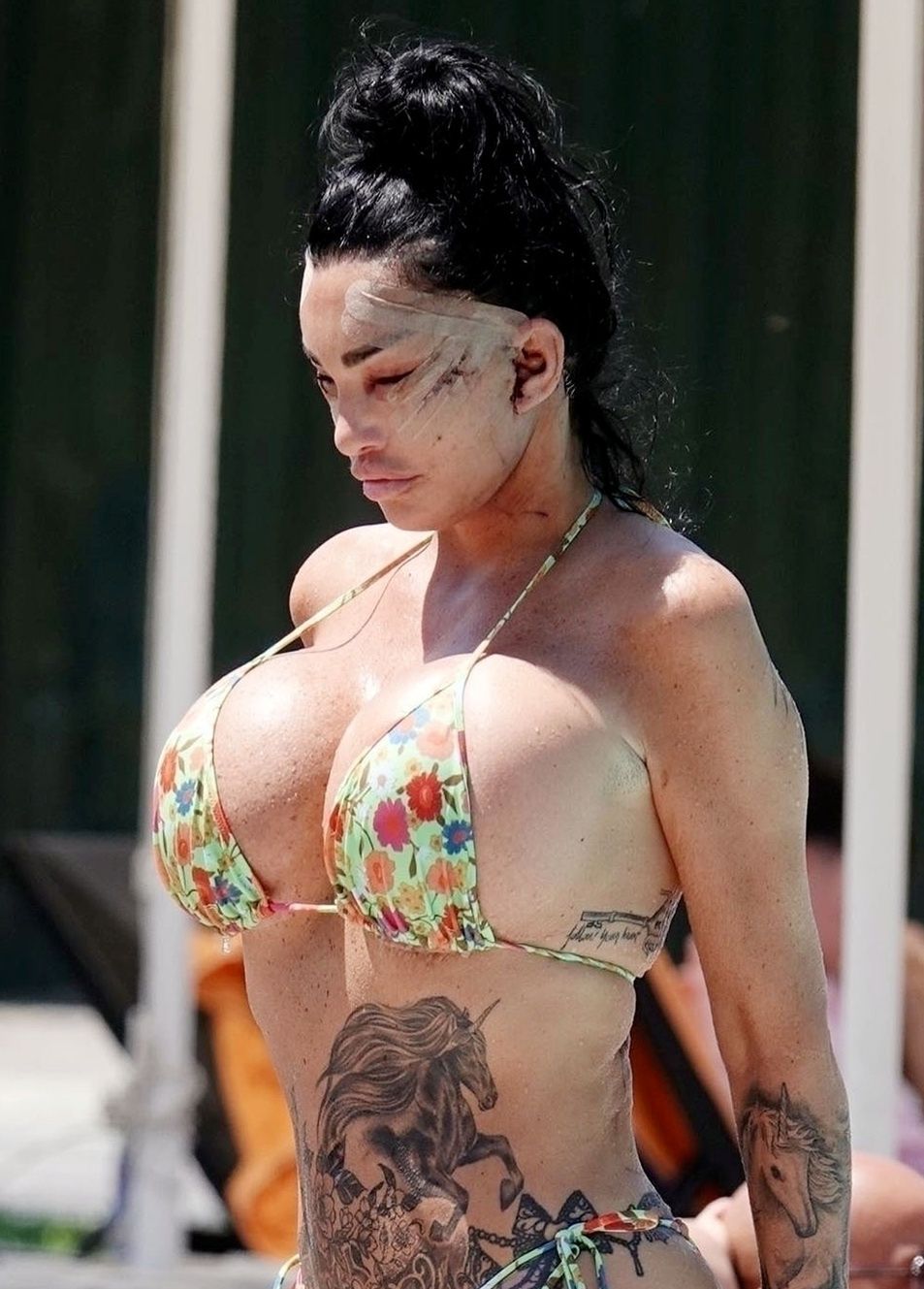 Katie Price w bikini. Pokazała się świeżo po operacji plastycznej
